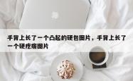 手背上长了一个凸起的硬包图片，手背上长了一个硬疙瘩图片